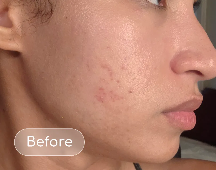Breakouts before