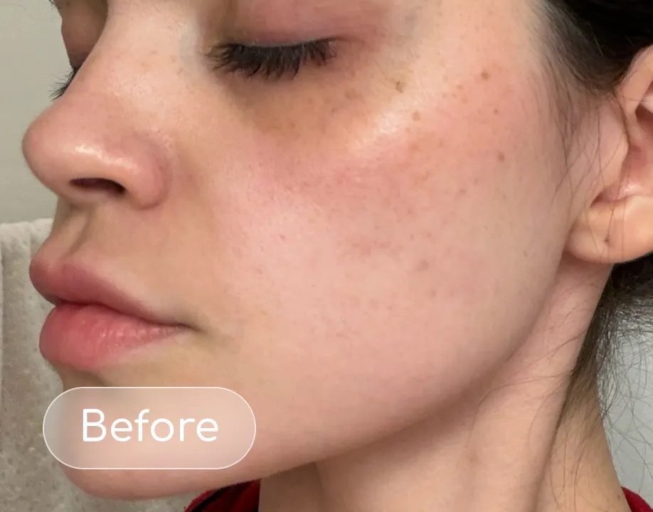 Redness before