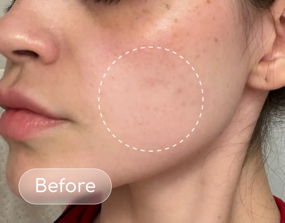 Redness before